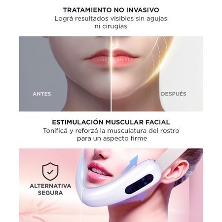 Mascara Facial de Electroestimulación Gadnic Reductora Lifting 7W 5V