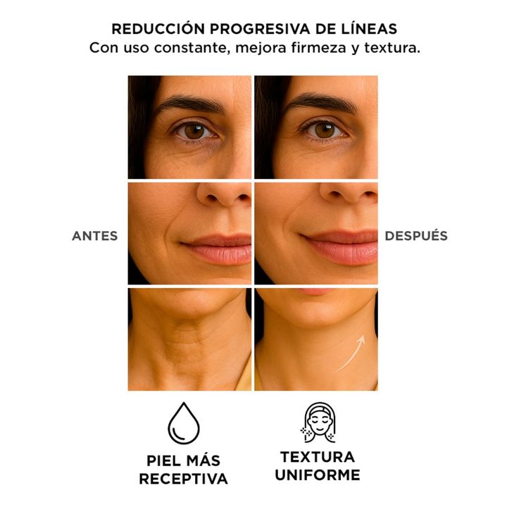 Masajeador Facial Radiofrecuencia Gadnic CPLED1 Rejuvenecedor 5v 4w - Vista 5