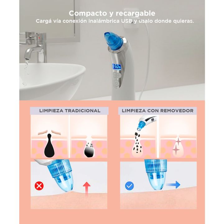 Limpiador Facial Care By Gadnic BF3078 Removedor de Puntos Negros 5 Velocidades - Vista 5