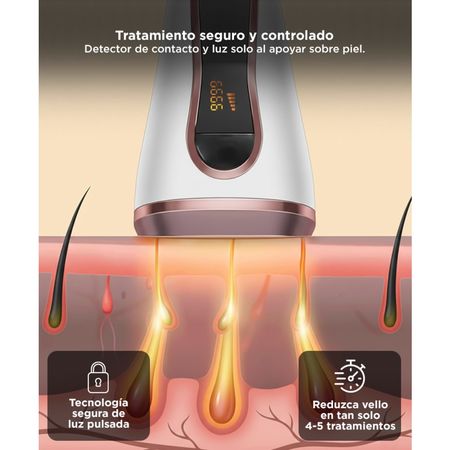 Depiladora Láser Negra Gadnic T3 Depilación Definitiva IPL 999,999 Pulsos 5 Niveles Filtro UV
