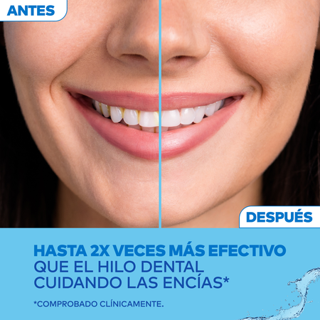 Irrigador Bucal WATERPIK ULTRA WP-100E